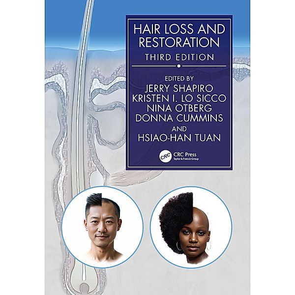 Hair Loss and Restoration