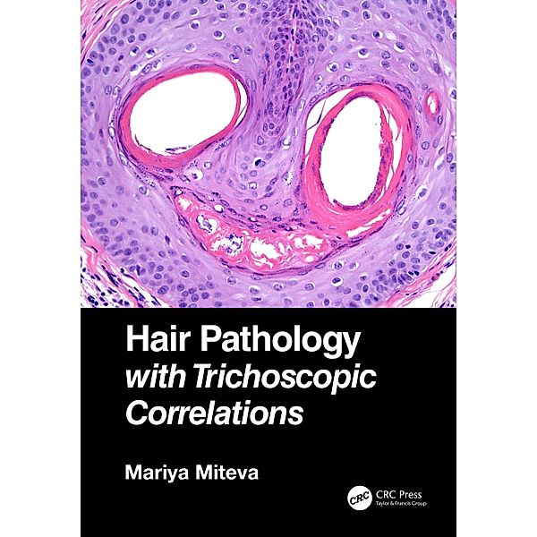 Hair Pathology with Trichoscopic Correlations, Mariya Miteva