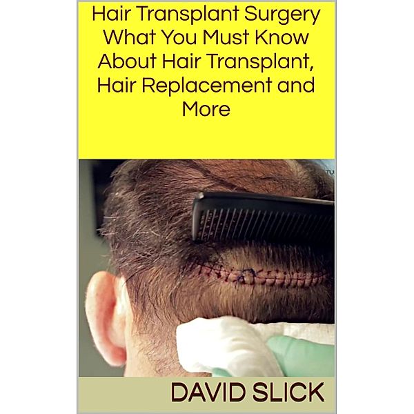 Hair Transplant Surgery, David Slick