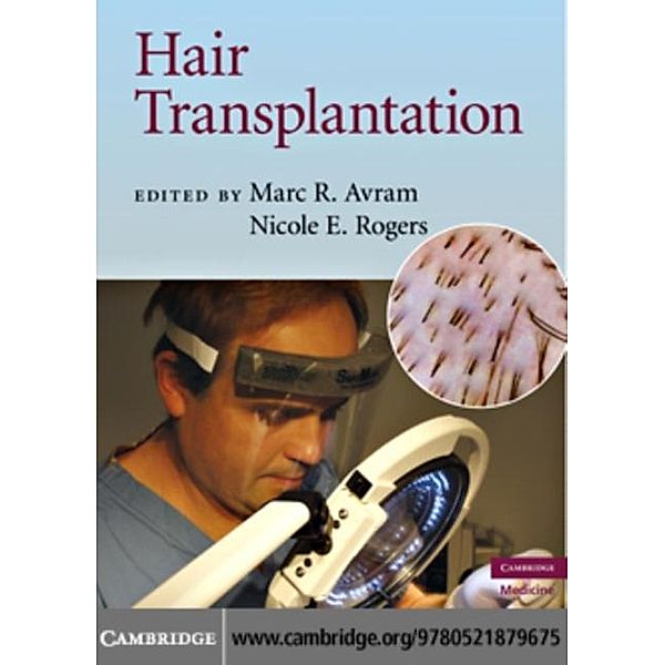 Hair Transplantation, Marc R. Avram