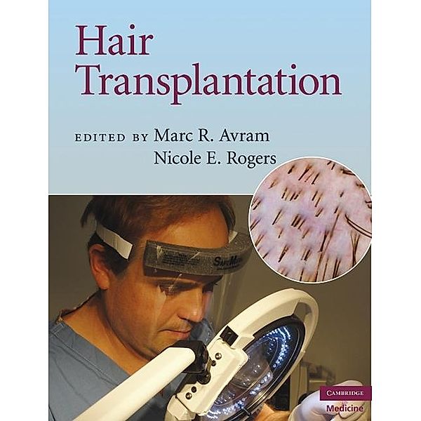 Hair Transplantation, Marc R. Avram