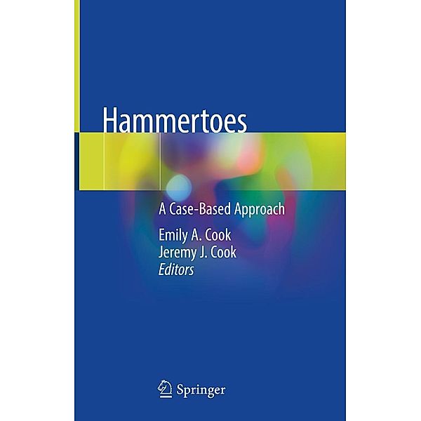 Hammertoes