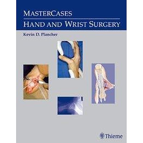 Hand and Wrist Surgery, Kevin D. Plancher