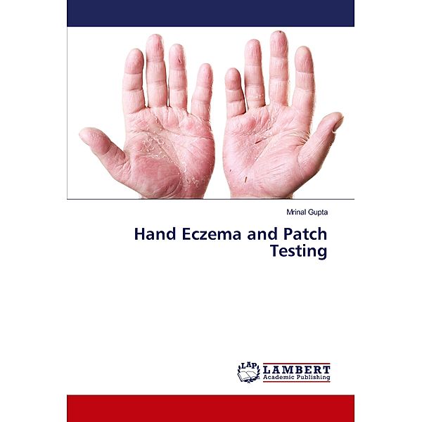 Hand Eczema and Patch Testing, Mrinal Gupta