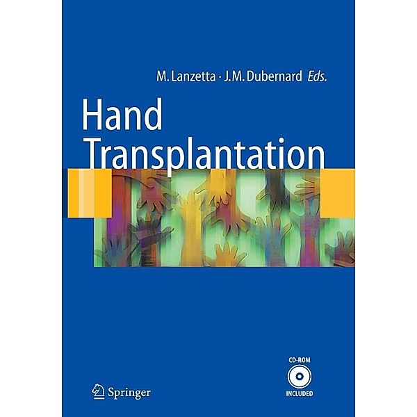 Hand transplantation