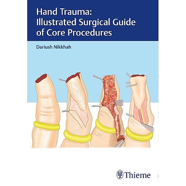 Hand Trauma: Illustrated Surgical Guide of Core Procedures, Dariush Nikkhah