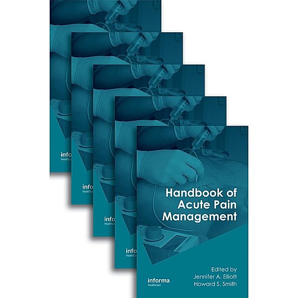 Handbook of Acute Pain Management