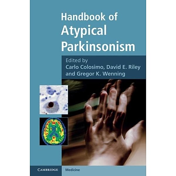 Handbook of Atypical Parkinsonism