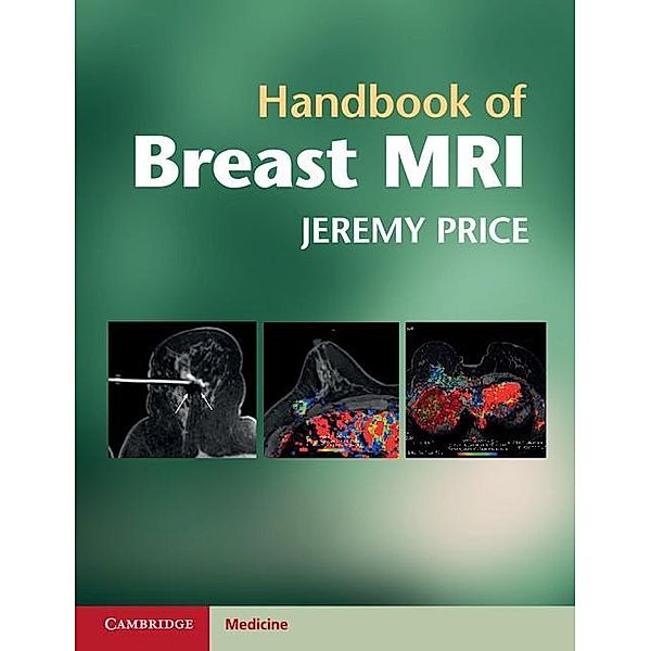 Handbook of Breast MRI, Jeremy Price