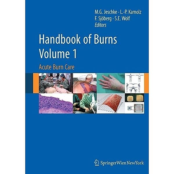 Handbook of Burns Volume 1, Lars-Peter Kamolz, Folke Sjöberg