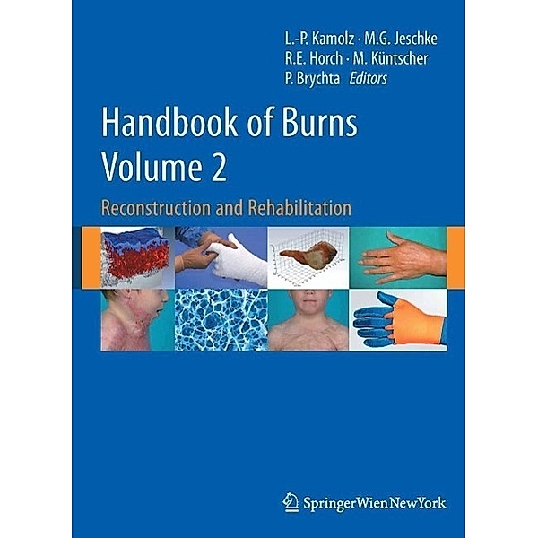 Handbook of Burns Volume 2, Lars-Peter Kamolz, Markus Küntscher, Pavel Brychta