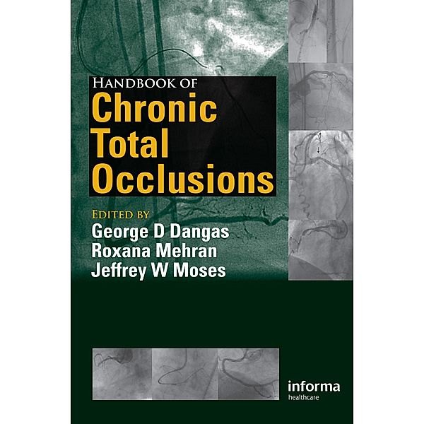 Handbook of Chronic Total Occlusions