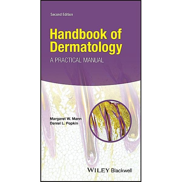 Handbook of Dermatology