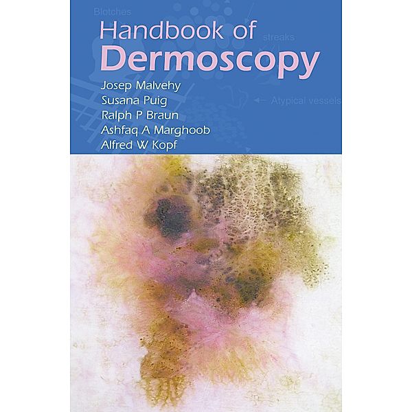 Handbook of Dermoscopy, Josep Malvehy, Ralph P. Braun, Susana Puig, Ashfaq A. Marghoob, Alfred W. Kopf