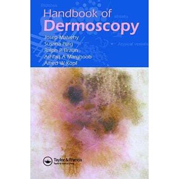 Handbook of Dermoscopy, Josep Malvehy, Ralph P. Braun, Susana Puig