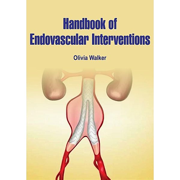 Handbook of Endovascular Interventions, Olivia Walker