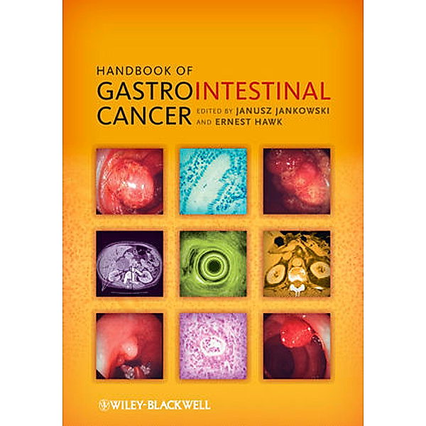 Handbook of Gastrointestinal Cancer, Janusz Jankowski