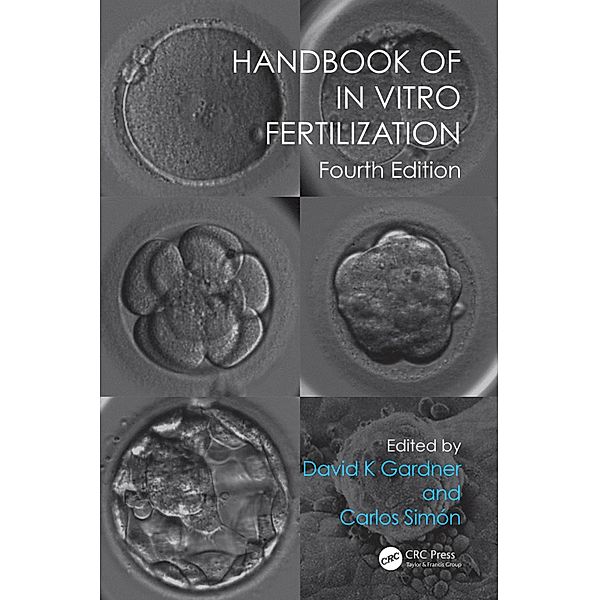 Handbook of In Vitro Fertilization