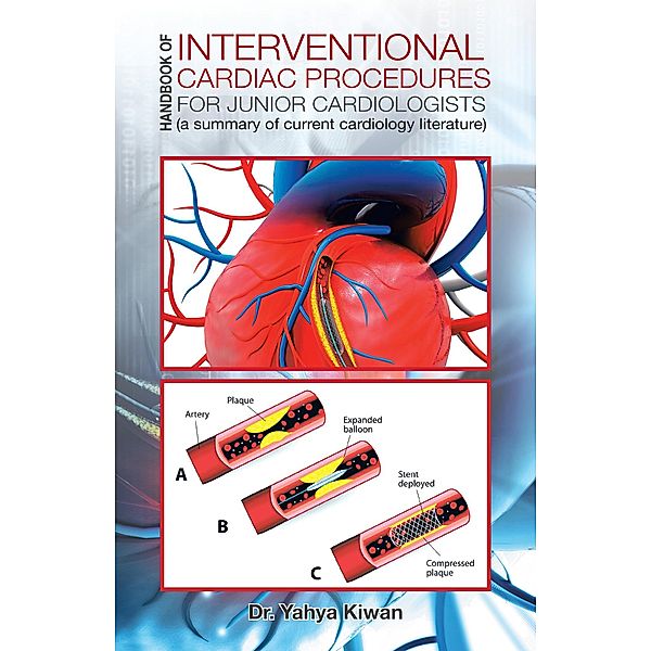 Handbook of Interventional Cardiac Procedures for Junior Cardiologists, Yahya Kiwan