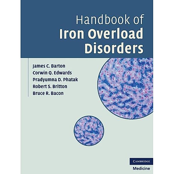 Handbook of Iron Overload Disorders, James C. Barton