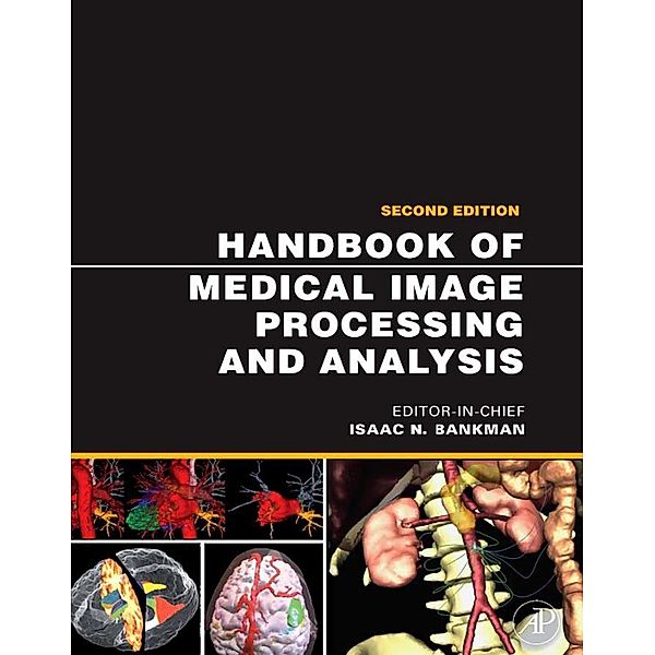 Handbook of Medical Image Processing and Analysis