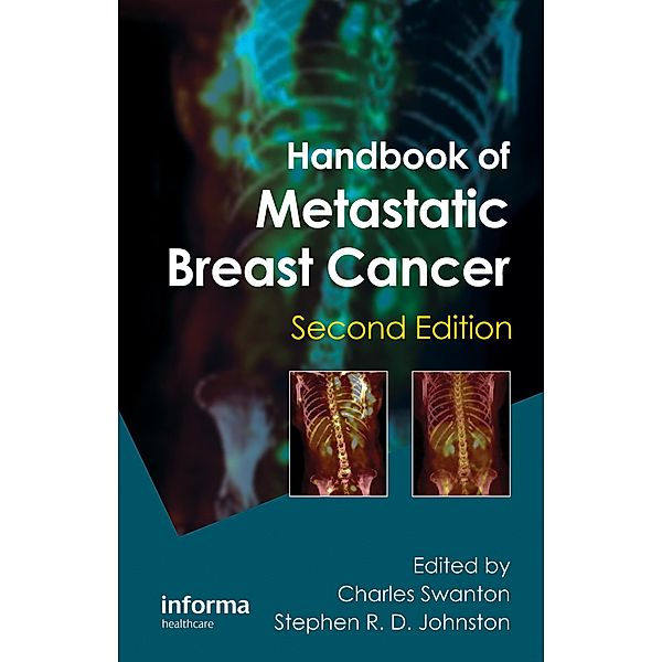 Handbook of Metastatic Breast Cancer