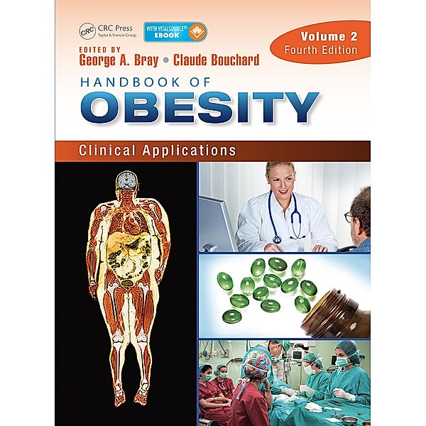 Handbook of Obesity - Volume 2, George Bray