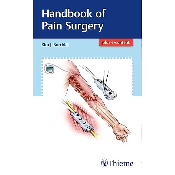 Handbook of Pain Surgery, Kim Burchiel