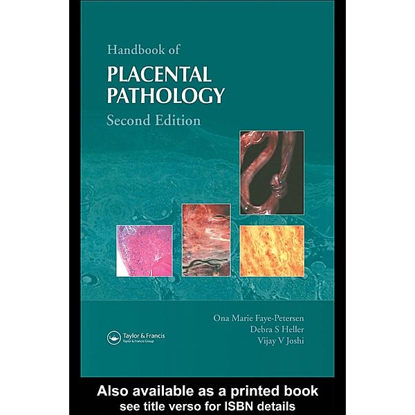 Handbook of Placental Pathology, Ona Marie Faye-Petersen, Debra S. Heller, Vijay V. Joshi