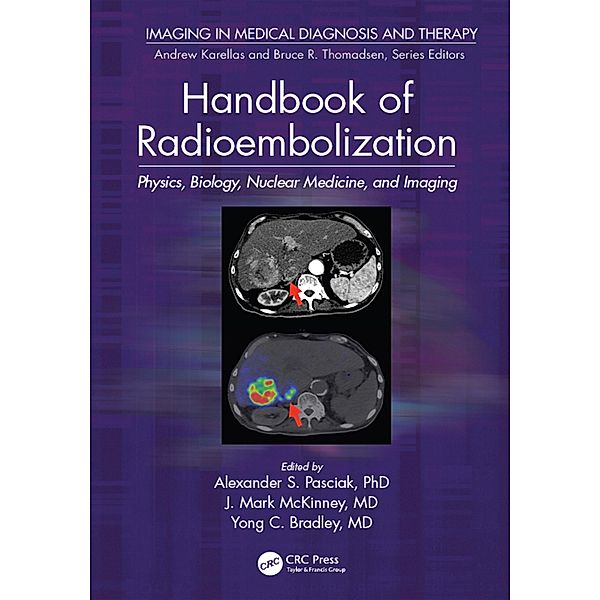 Handbook of Radioembolization