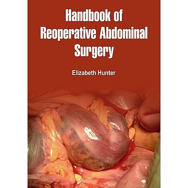 Handbook of Reoperative Abdominal Surgery, Elizabeth Hunter