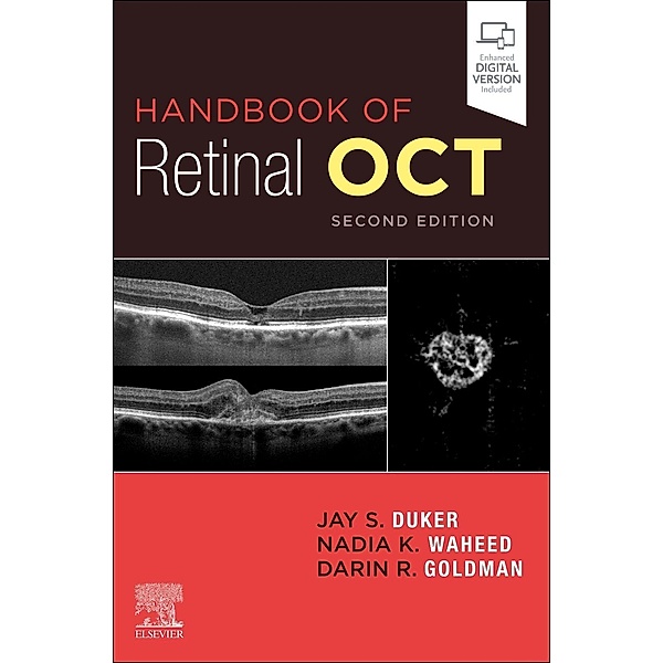 Handbook of Retinal OCT, Jay S. Duker, Nadia K Waheed, Darin Goldman