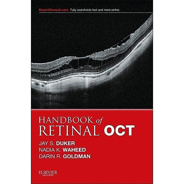 Handbook of Retinal OCT: Optical Coherence Tomography, Jay S. Duker, Nadia K Waheed, Darin Goldman