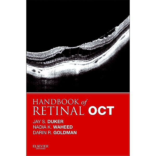 Handbook of Retinal OCT: Optical Coherence Tomography E-Book, Jay S. Duker, Nadia K. Waheed, Darin Goldman