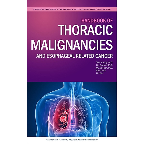 Handbook of Thoracic Malignancies and Esophageal Related Cancer, Tian Yulong, Liu Guohao, Qu Xiaohan, Shao Hua, Liu Wei