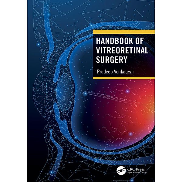 Handbook of Vitreoretinal Surgery, Pradeep Venkatesh