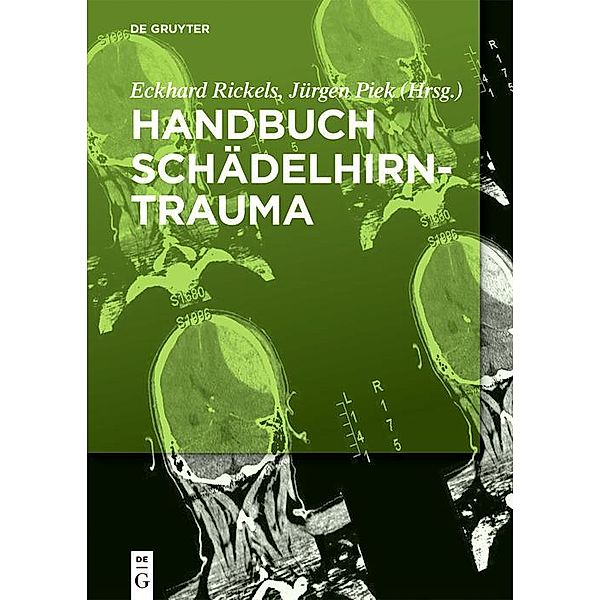 Handbuch Schädelhirntrauma