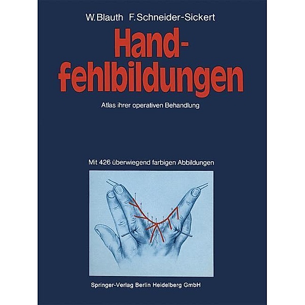 Handfehlbildungen, W. Blauth, F. Schneider-Sickert