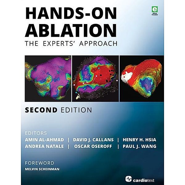 Hands-On Ablation