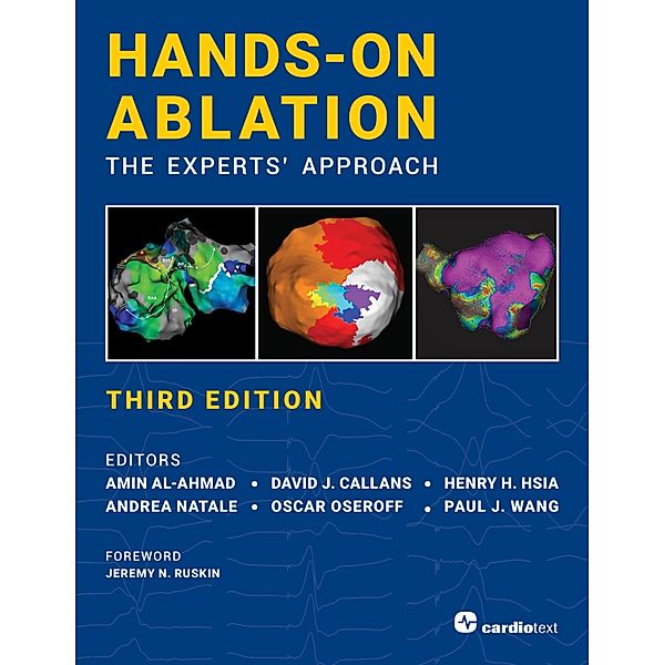 Hands-On Ablation, The Experts' Approach, Third Edition
