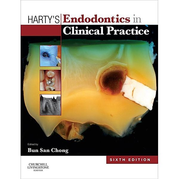 Harty's Endodontics in Clinical Practice, Bun San Chong
