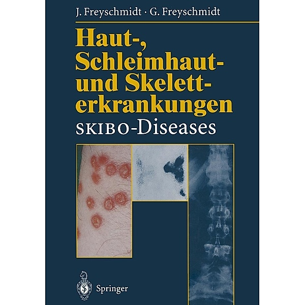 Haut-, Schleimhaut- und Skeletterkrankungen SKIBO-Diseases, Jürgen Freyschmidt, Gisela Freyschmidt