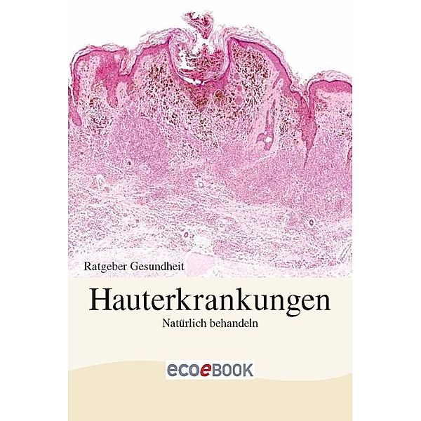 Hauterkrankungen - Natürlich behandeln, Red. Serges Verlag