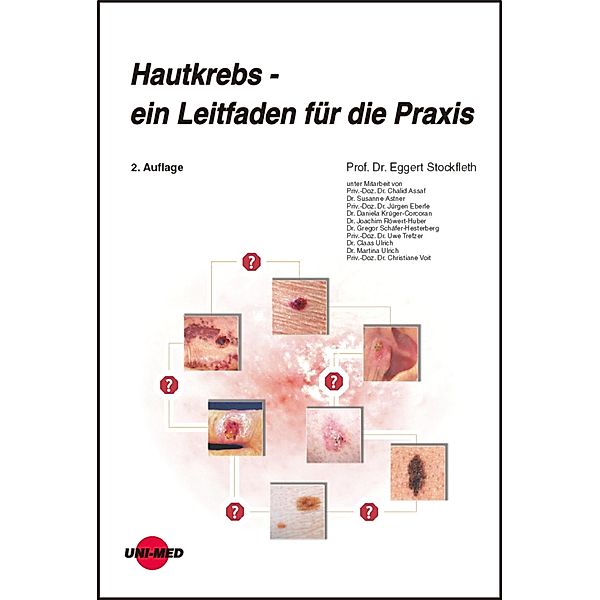 Hautkrebs - ein Leitfaden für die Praxis / UNI-MED Science, Eggert Stockfleth