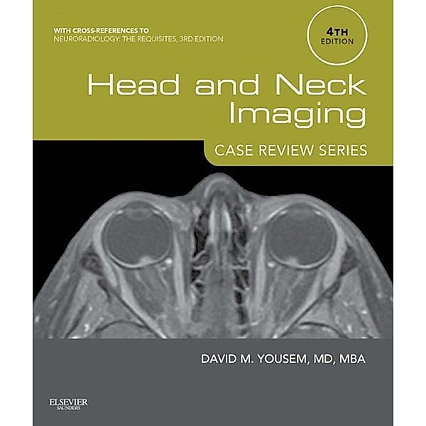 Head and Neck Imaging: Case Review Series E-Book / Case Review, David M. Yousem
