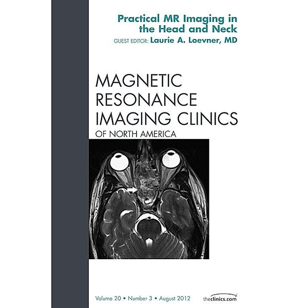 Head and Neck MRI, An Issue of Magnetic Resonance Imaging Clinics, Laurie A. Loevner