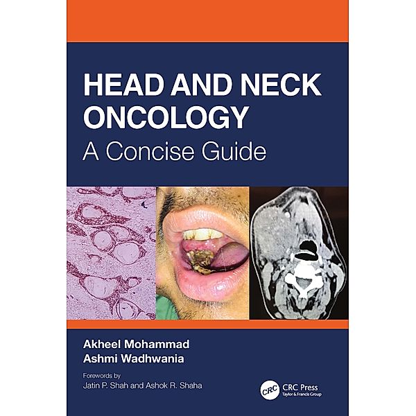 Head and Neck Oncology, Akheel Mohammad, Ashmi Wadhwania