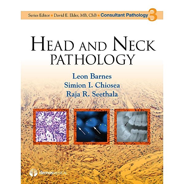 Head and Neck Pathology / Consultant Pathology Bd.Volume 3, Leon Barnes, Simion I. Chiosea, Raja R. Seethala