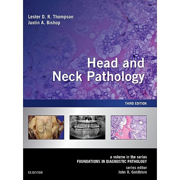 Head and Neck Pathology E-Book, Lester D. R. Thompson, Justin A. Bishop