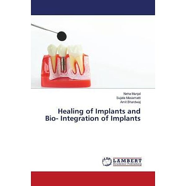 Healing of Implants and Bio- Integration of Implants, Neha Munjal, Sujata Masamatti, Amit Bhardwaj